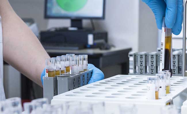 Coronavirus, dott. Conenna: “Casi aumenteranno per altre tre settimane, ma c’è una differenza col Nord”