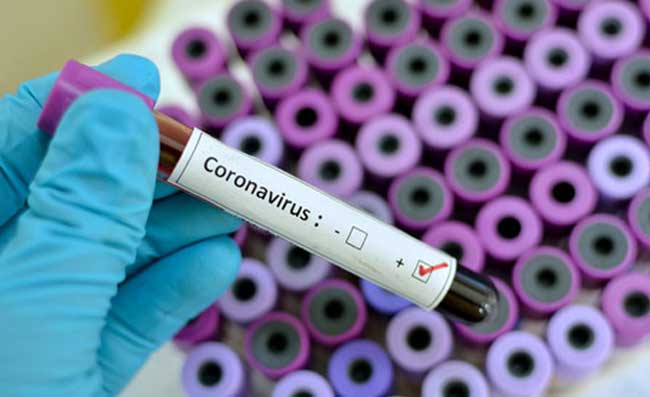 Napoli, si piange un’altra vittima del Coronavirus in città: arriva il comunicato dell’ASIA