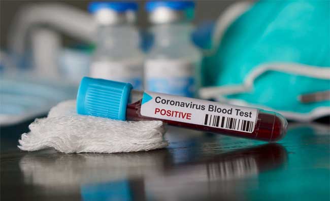 Coronavirus Campania, bollettino del 29 maggio: 10 nuovi positivi su 4364 tamponi