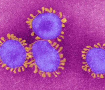 Coronavirus, il Ceinge individua la sequenza genetica del virus su un paziente campano