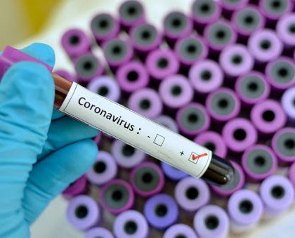 Il Cts valuta una modifica al protocollo: tamponi ogni 5-7 giorni e non più ogni 4