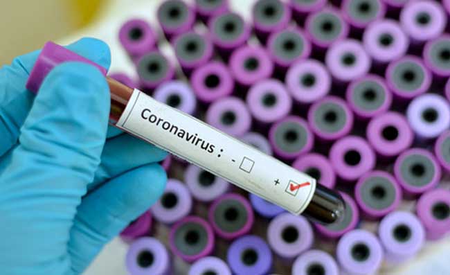 Coronavirus, arriva il vaccino italiano da Castel Romano: costerà tra i 5 e i 10 euro