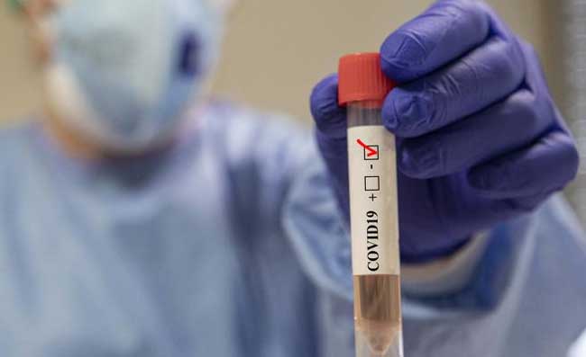 Napoli, nuovo positivo nello staff tecnico: il comunicato ufficiale. Attesi altri tamponi