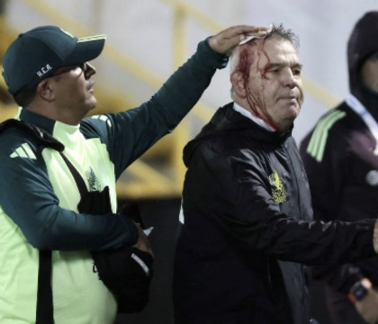 Aguirre il ct messicano glorifica la violenza: prende una lattina in testa e dice “non è niente, è il calcio”